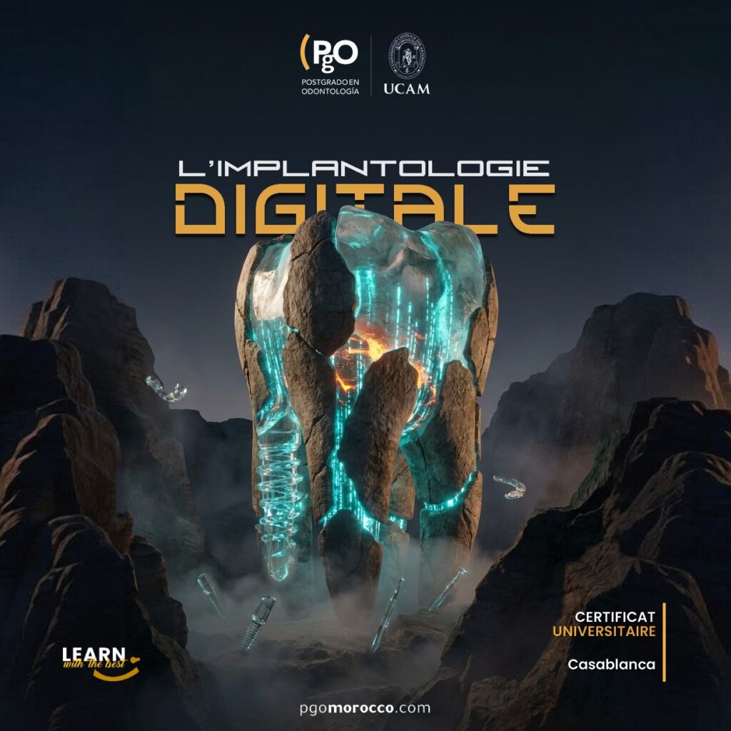 Certificat Universitaire de l'Implantologie Digitale (CUID)
