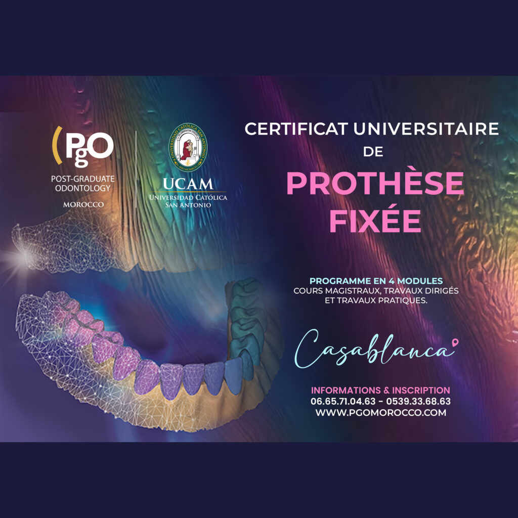 Certificat Universitaire de Prothèse Fixée (CUPF)